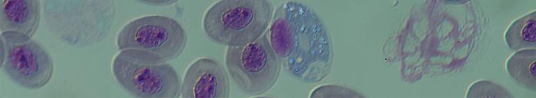 Immunology and Infection