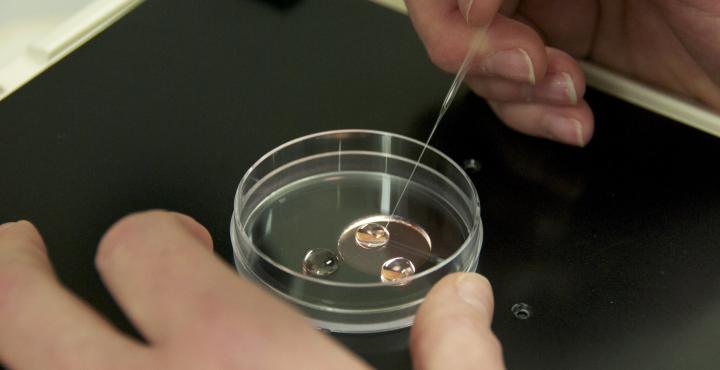 Embryo transfer picture