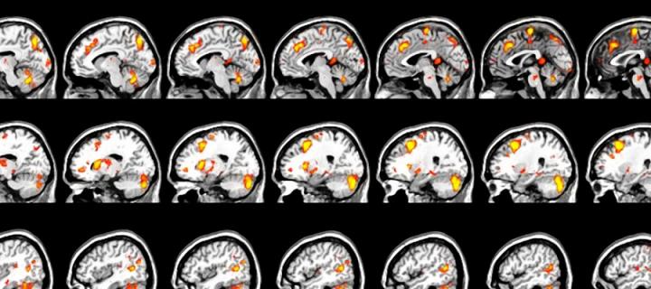 Brain scan