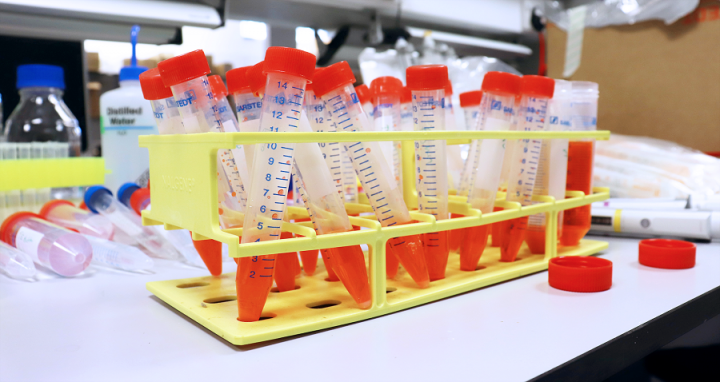 Adipic acid bacteria samples - Image Credit: The Wallace Lab