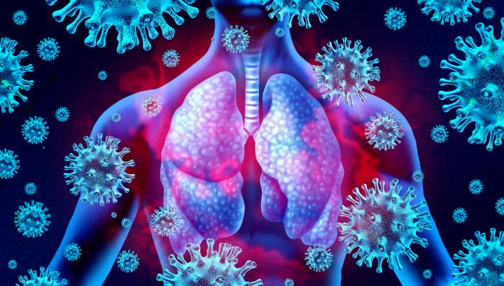 Image of chest with longs visible surrounded by coronavirus