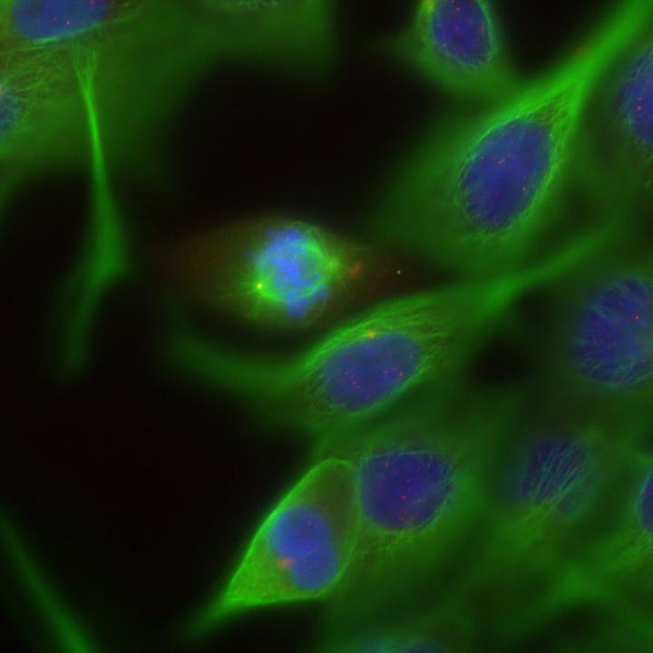 After Deconvolution