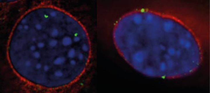 Wild-type and an EDMD disease mutant version of PLPP7 expressed in muscle cells 