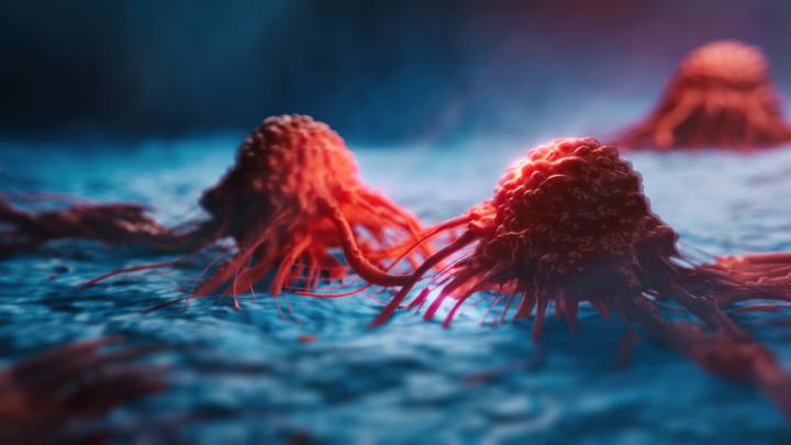 Cancer cell image