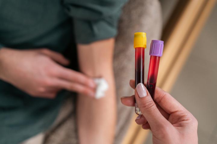 Blood test