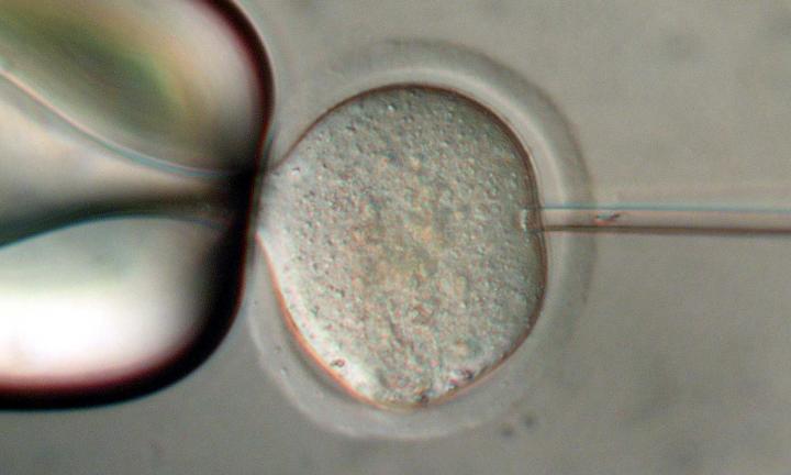 Intracytoplasmic sperm injection