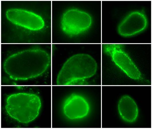 Image from Schirmer paper, Mol Cell Protromics 2010