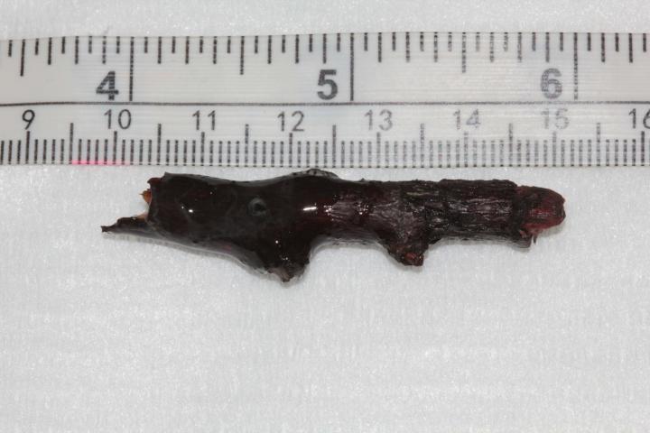 Stick removed from Mia's eye