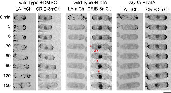 Image from Sawin paper current Biology 2016