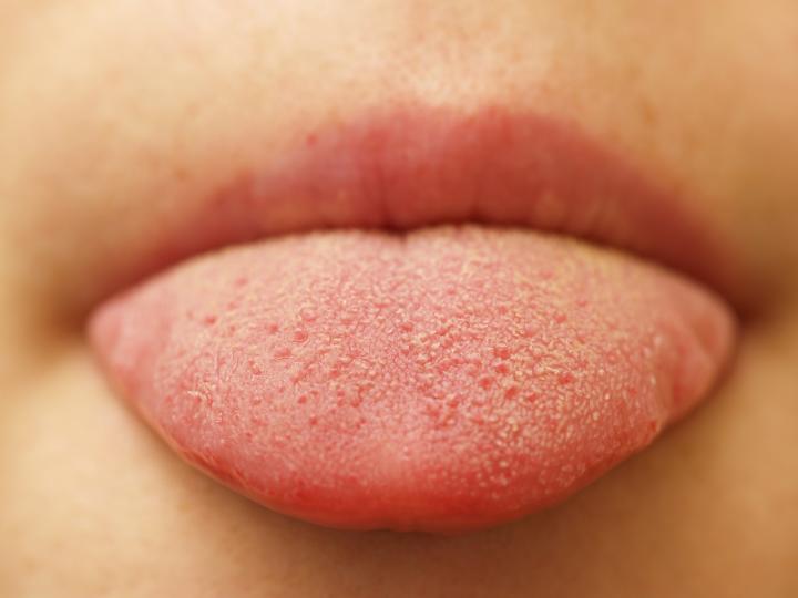 Tongue2.