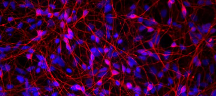 Microscopic black, purple and red image of cells