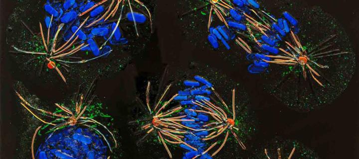 Glass lab image of cells