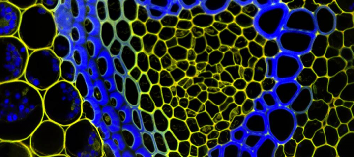 Transverse section fo a root (Lily of the Valley)