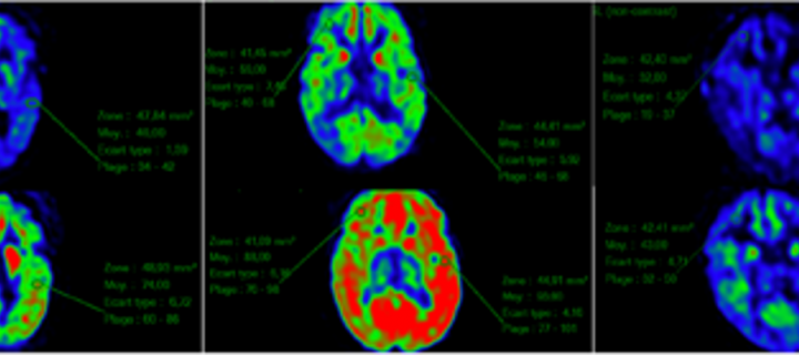 Brain images