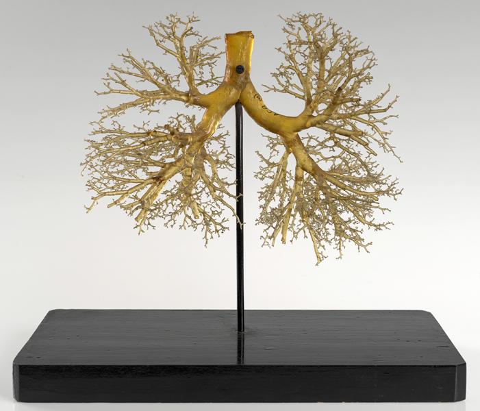 Lung resin cast model