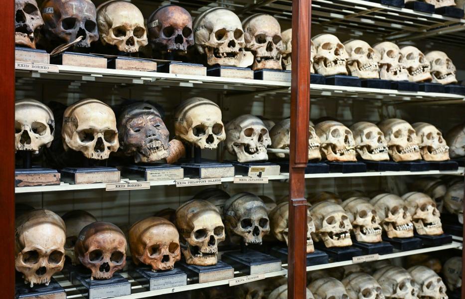The University of Edinburgh skull room with skulls on shelves in a glass cabinet
